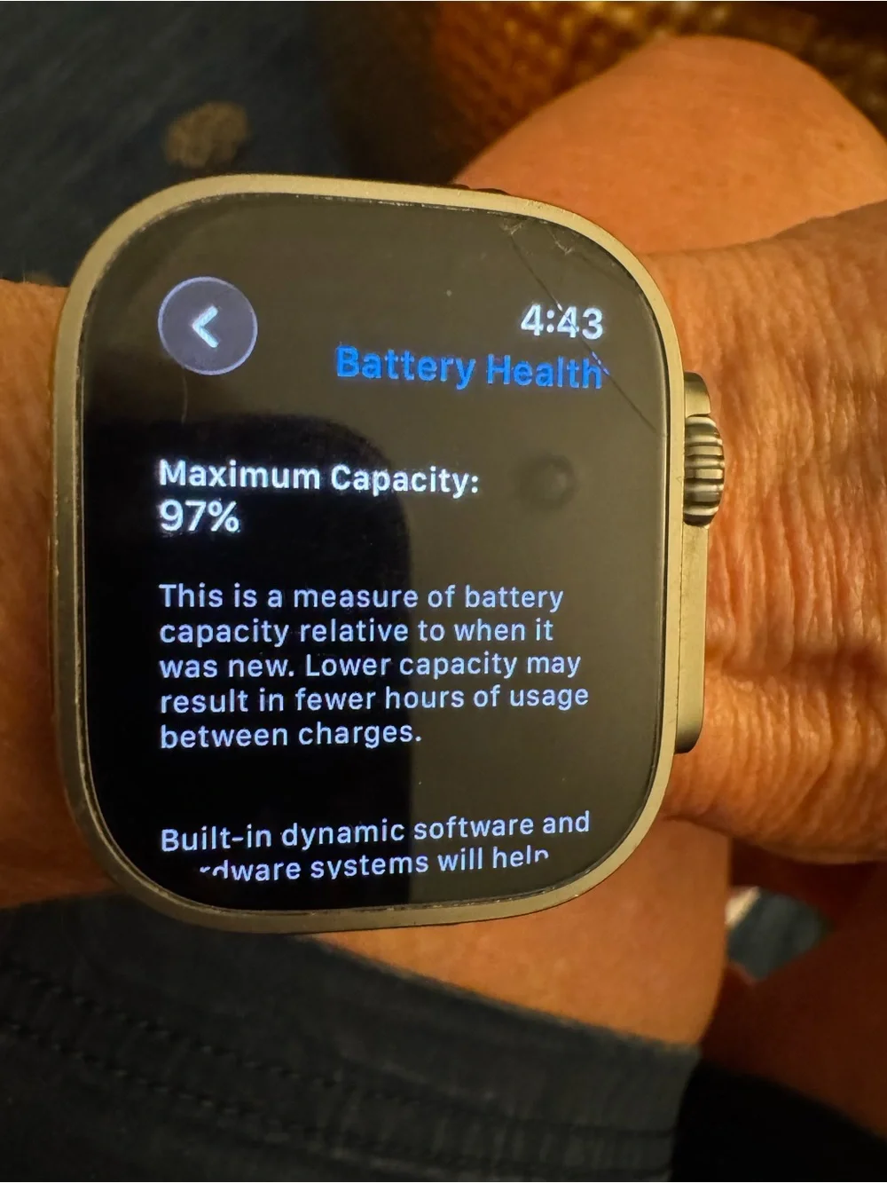 Apple Watch Ultra(1st Generation)49mm  Please read and look at all pictures!